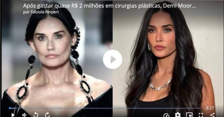 Após gastar quase R$ 2 milhões em cirurgias plásticas, Demi Moore remove preenchimentos do rosto